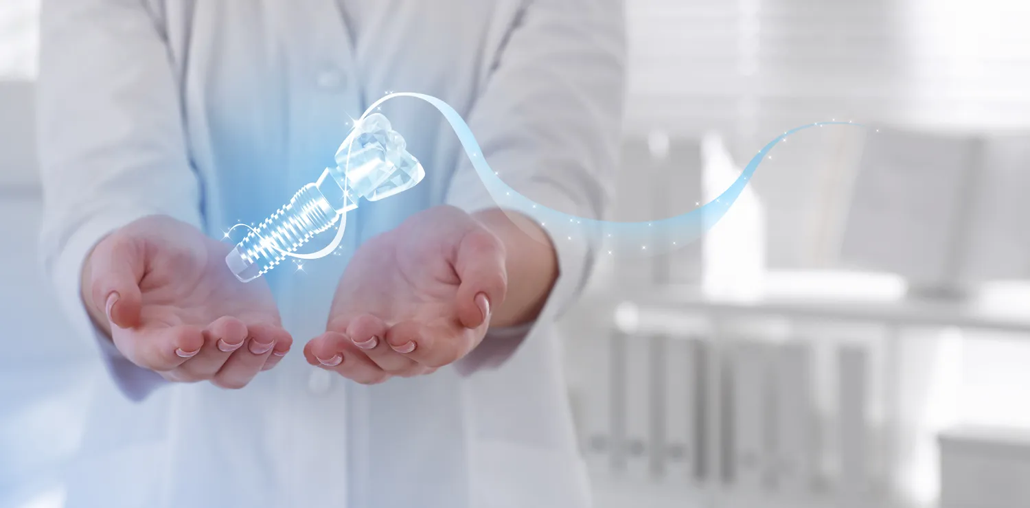 Ile kosztują implanty zębów?