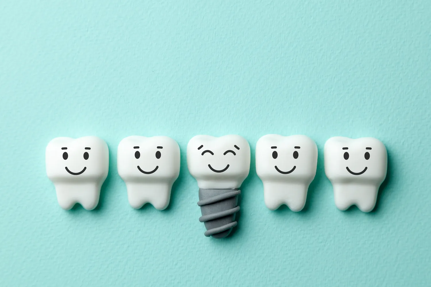 Implanty zębowe to gwarancja zdrowego uśmiechu