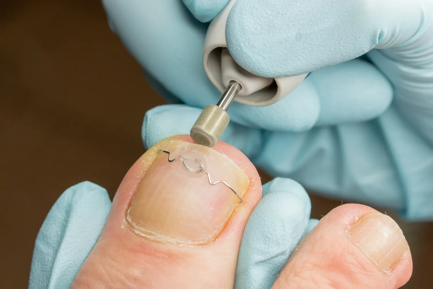 Kiedy należy udać się do gabinetu podologicznego?