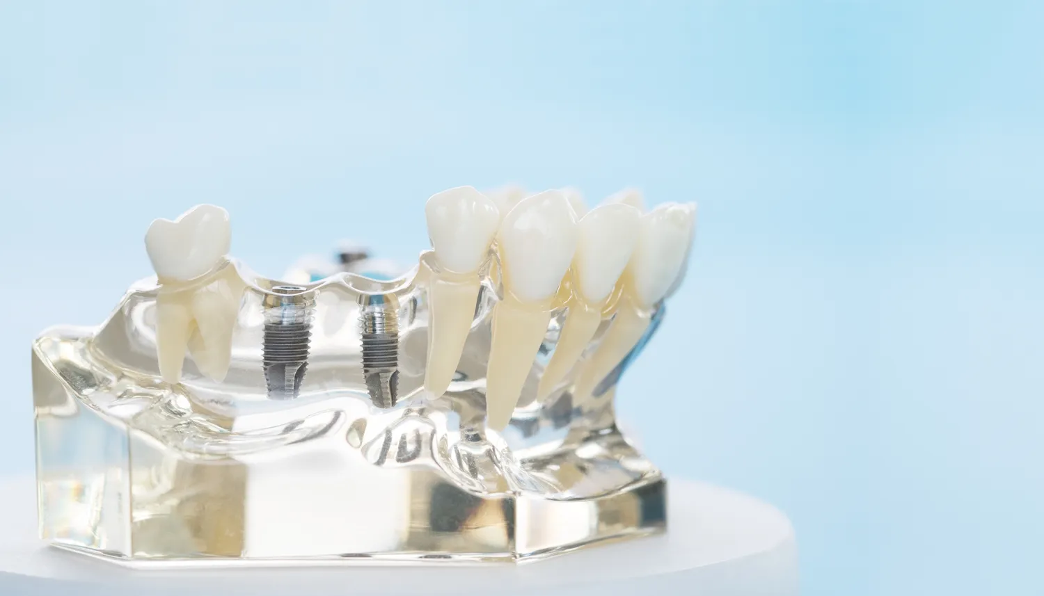 Najlepsza endodoncja Szczecin
