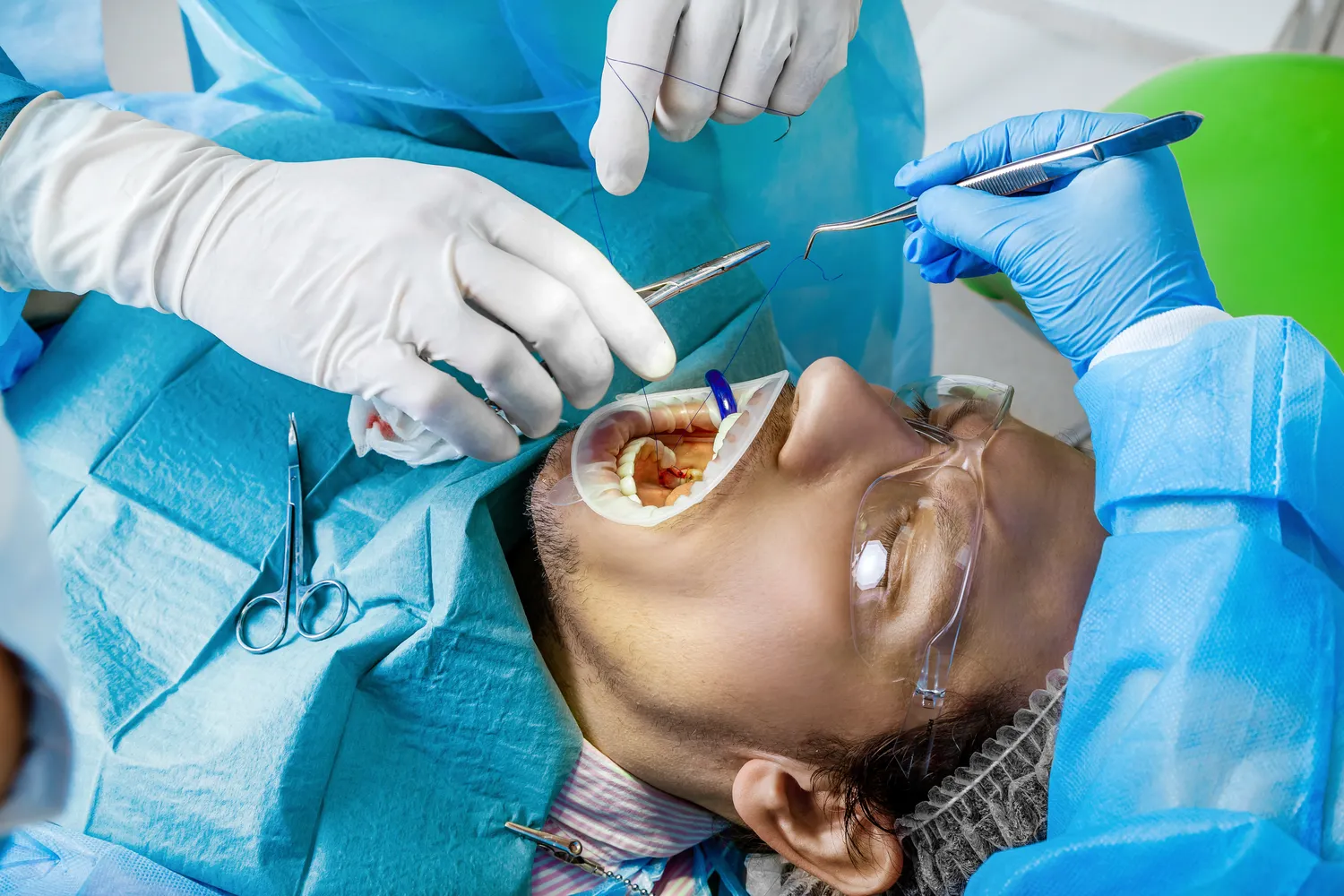 Ile kosztuje implanty?